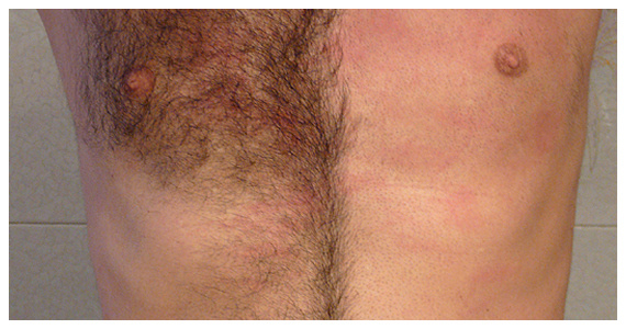 male_body_waxing